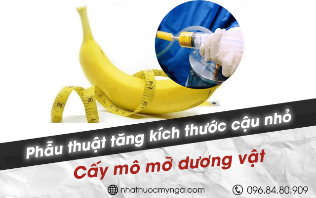 phẫu thuật cấy mỡ tăng kích thước cậu nhỏ