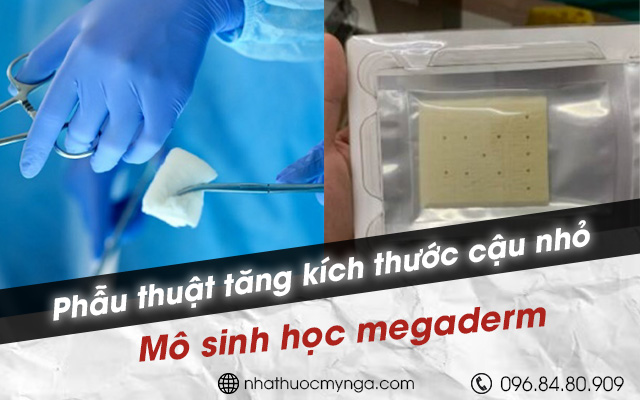 Mô sinh học megaderm tăng kích thước cậu nhỏ