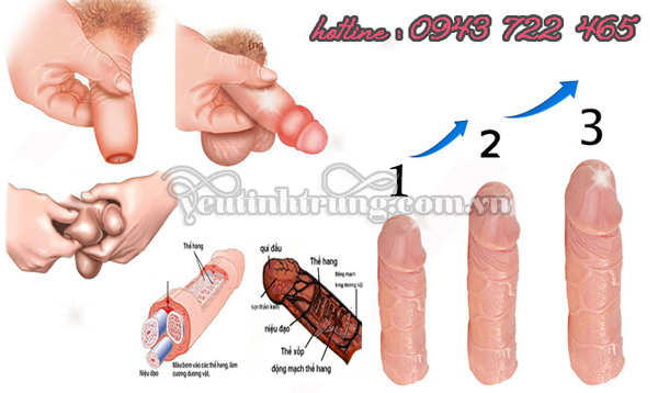 bai-tap-tang-kich-thuoc-cau-nho-2