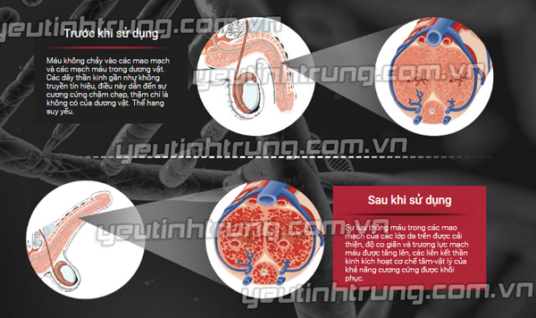 gel-titan-gay-tu-vong-4