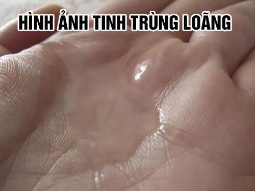 tinh trùng loãng là gì